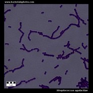 streptococcus agalactiae under microscope